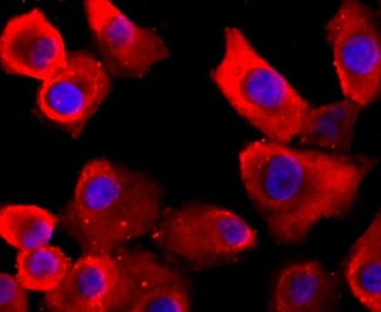 VCP Rabbit Monoclonal Antibody