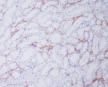 Collagen I COL1A1 Rabbit Monoclonal Antibody