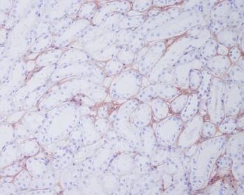 Anti-Collagen I COL1A1 Rabbit Monoclonal Antibody