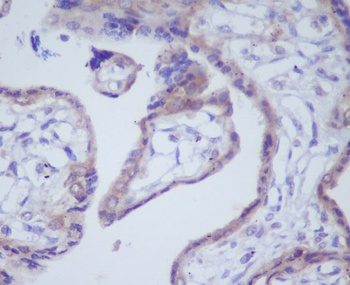 Anti-DKK1 Rabbit Monoclonal Antibody