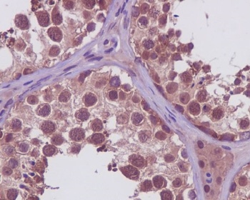 Anti-PRMT5 Rabbit Monoclonal Antibody
