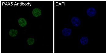 PAX5/Bsap Rabbit Monoclonal Antibody