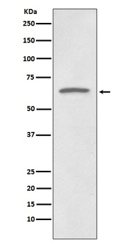 p73 Rabbit Monoclonal Antibody