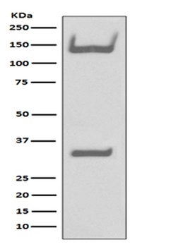 Anti-TrkA+B+C NTRK1 Rabbit Monoclonal Antibody