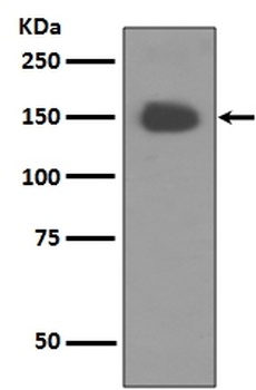 Anti-TrkA NTRK1 Rabbit Monoclonal Antibody