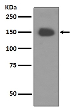 TrkA NTRK1 Rabbit Monoclonal Antibody