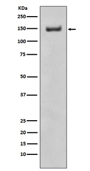 Anti-ROCK1 Rabbit Monoclonal Antibody