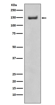 ROCK1 Rabbit Monoclonal Antibody