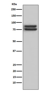Anti-FOXP1 Monoclonal Antibody