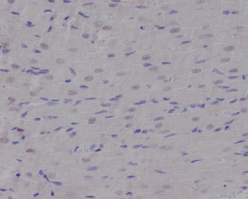 p95/NBS1 NBN Rabbit Monoclonal Antibody