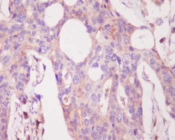 Anti-PKC alpha PRKCA Rabbit Monoclonal Antibody