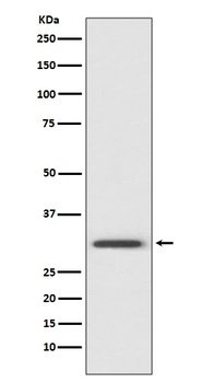 Annexin V ANXA5 Rabbit Monoclonal Antibody