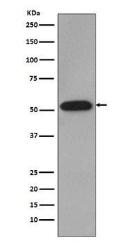 Anti-Cyclin B1 CCNB1 Rabbit Monoclonal Antibody