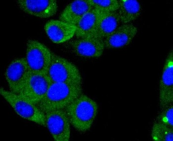 ACE2 Rabbit Monoclonal Antibody