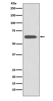 Anti-SOX10 Rabbit Monoclonal Antibody