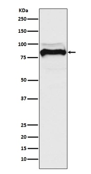 Anti-TGF beta Receptor II TGFBR2 Rabbit Monoclonal Antibody