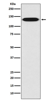 Integrin beta 1 ITGB1 Rabbit Monoclonal Antibody