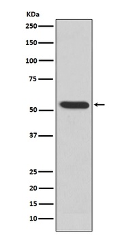 Anti-MMP3 Rabbit Monoclonal Antibody