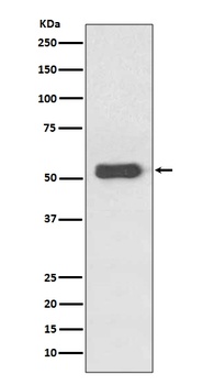 Anti-Estrogen Receptor beta ESR2 Rabbit Monoclonal Antibody