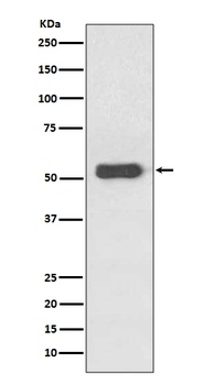 Estrogen Receptor beta ESR2 Rabbit Monoclonal Antibody