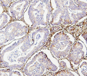 Anti-Collagen III/COL3A1 Antibody (monoclonal, 9H9)