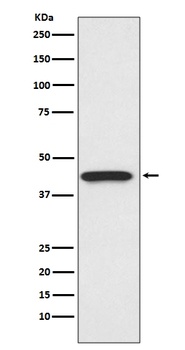 CDK9 Rabbit Monoclonal Antibody