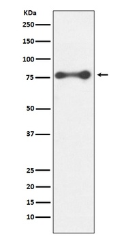 PKC delta PRKCD Rabbit Monoclonal Antibody