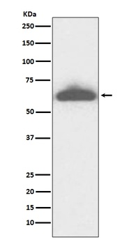 RPE65 Rabbit Monoclonal Antibody