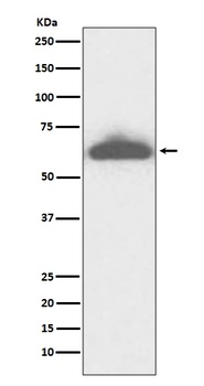 Anti-RPE65 Rabbit Monoclonal Antibody