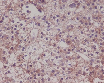 Anti-LRP1/Lrp 1 Cluster Ii Rabbit Monoclonal Antibody