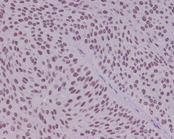 Anti-YY1 Rabbit Monoclonal Antibody
