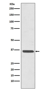 Anti-Annexin A2 ANXA2 Rabbit Monoclonal Antibody