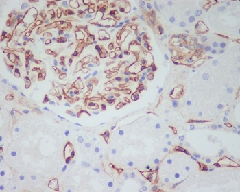 CD34 Rabbit Monoclonal Antibody