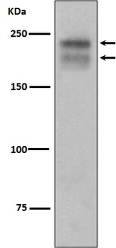 Anti-VEGF Receptor 2 KDR Rabbit Monoclonal Antibody