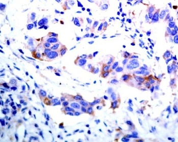 Anti-ASK1 MAP3K5 Rabbit Monoclonal Antibody