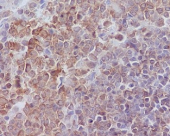 Anti-SHP1 PTPN6 Rabbit Monoclonal Antibody