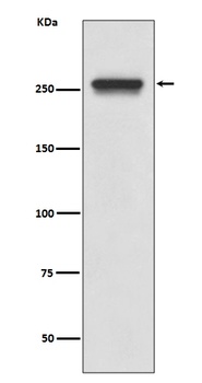 Anti-FASN/Fatty Acid Synthase Rabbit Monoclonal Antibody