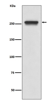 FASN/Fatty Acid Synthase Rabbit Monoclonal Antibody