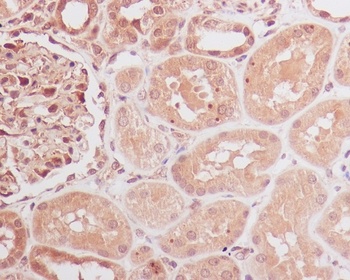 Id1 Rabbit Monoclonal Antibody