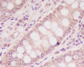 M6PR IGF2R Rabbit Monoclonal Antibody
