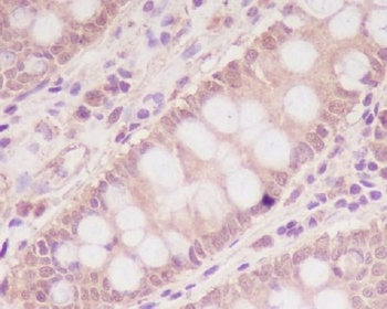 Anti-M6PR IGF2R Rabbit Monoclonal Antibody