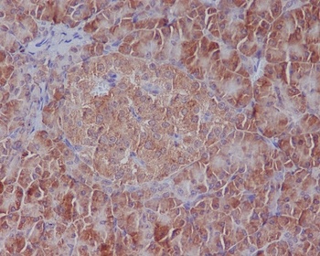 GRP78 BiP HSPA5 Rabbit Monoclonal Antibody