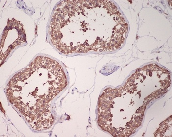 Anti-GRP78 BiP HSPA5 Rabbit Monoclonal Antibody
