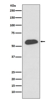 IRF5 Rabbit Monoclonal Antibody