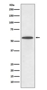 Anti-IRF5 Rabbit Monoclonal Antibody