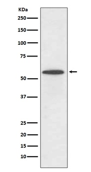 IRF5 Rabbit Monoclonal Antibody