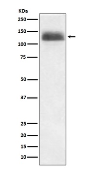 NFAT1 NFATC2 Rabbit Monoclonal Antibody