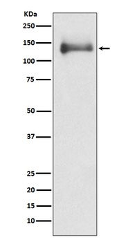 Anti-HDAC4/Histone Deacetylase 4 Rabbit Monoclonal Antibody