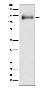 HDAC4/Histone Deacetylase 4 Rabbit Monoclonal Antibody