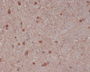Anti-S100B/S100 Beta Rabbit Monoclonal Antibody